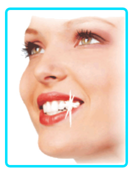 Kozmetikai fogászat